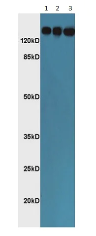 Western blot - Anti-Angiotensin Converting Enzyme 1 antibody (AB216476)