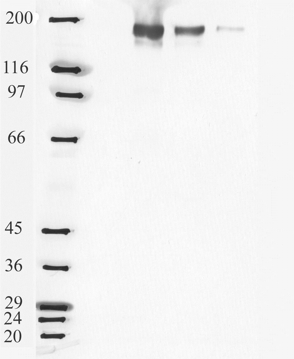 Western blot - Anti-Angiotensin Converting Enzyme 1 antibody (AB28311), expandable thumbnail
