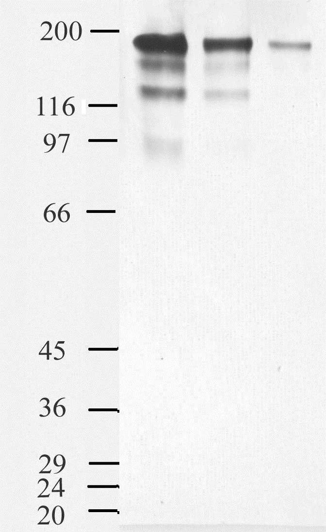 Western blot - Anti-Angiotensin Converting Enzyme 1 antibody (AB39172)