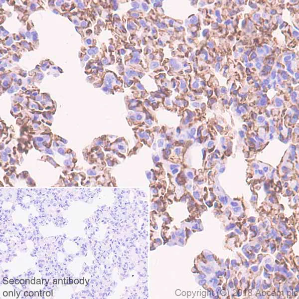 Immunohistochemistry (Formalin/PFA-fixed paraffin-embedded sections) - Anti-Angiotensin Converting Enzyme 1 antibody [EPR22250-204] (AB222739)