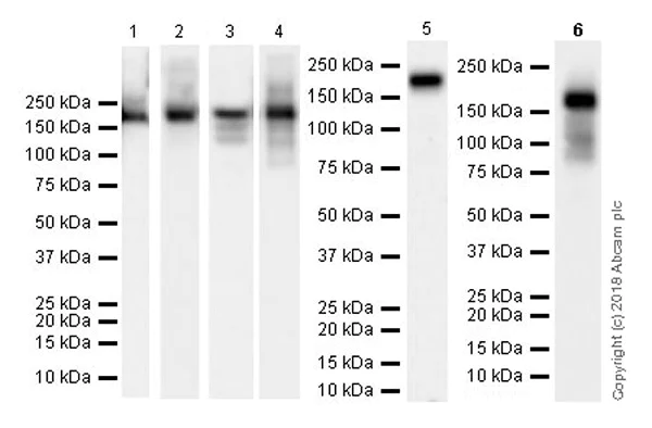 Western blot - Anti-Angiotensin Converting Enzyme 1 antibody [EPR22250-204] (AB222739)