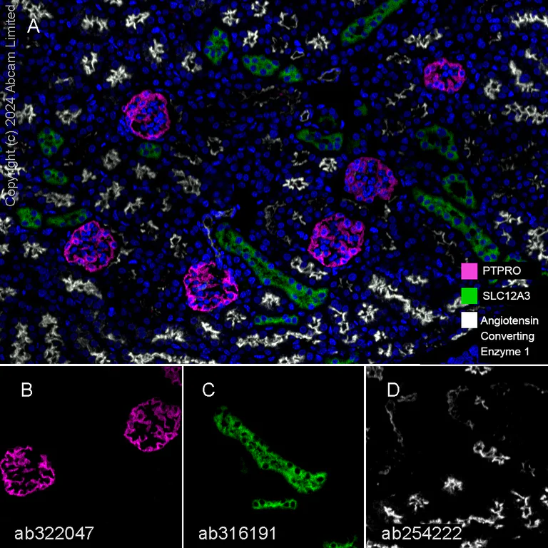 Multiplex immunohistochemistry - Anti-Angiotensin Converting Enzyme 1 antibody [EPR22291-247] (AB254222)