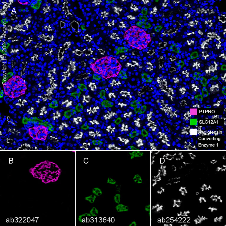 Multiplex immunohistochemistry - Anti-Angiotensin Converting Enzyme 1 antibody [EPR22291-247] (AB254222)
