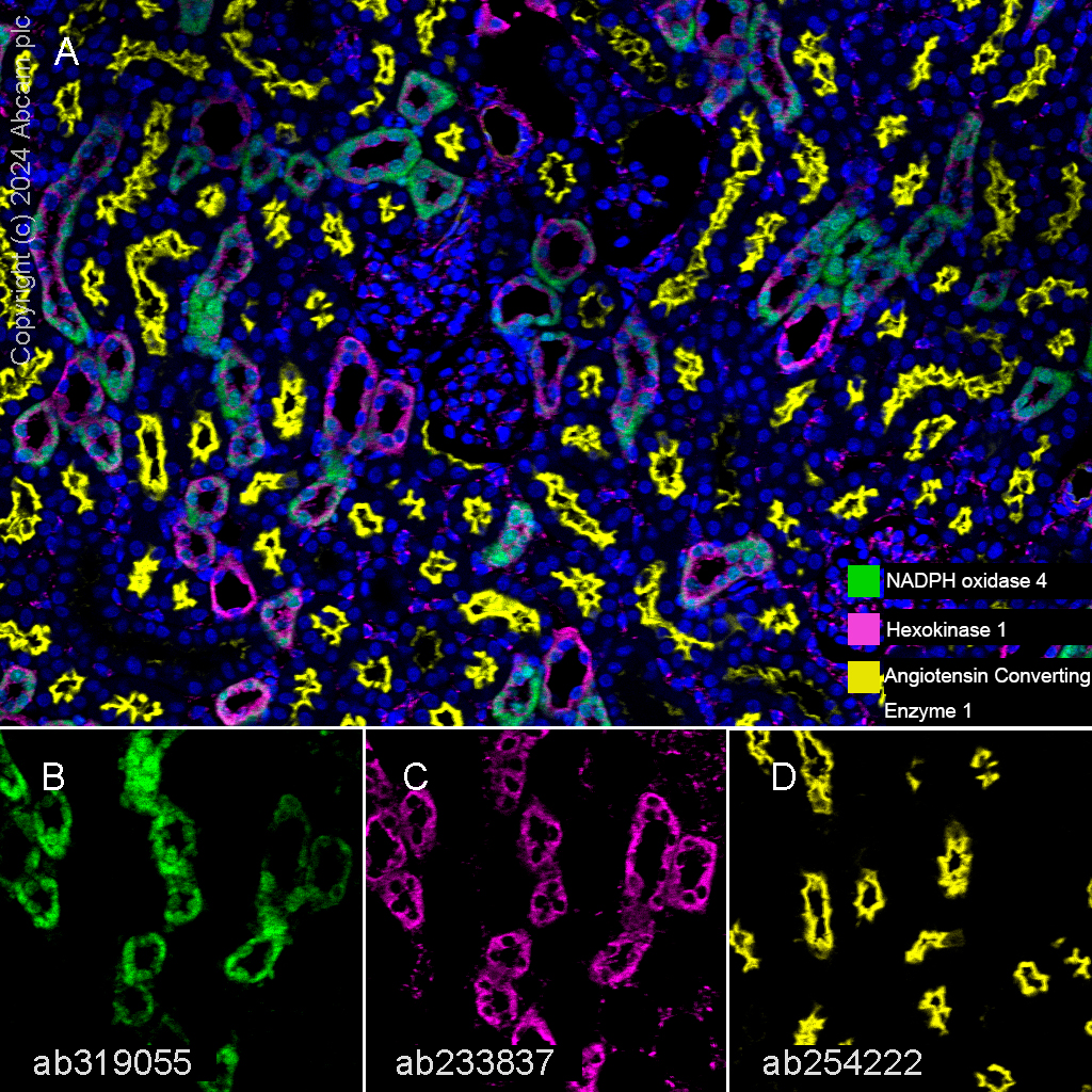 Anti-Angiotensin Converting Enzyme 1 antibody [EPR22291-247