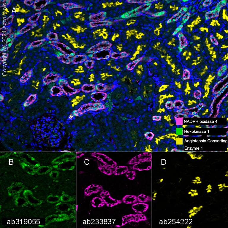 Multiplex immunohistochemistry - Anti-Angiotensin Converting Enzyme 1 antibody [EPR22291-247] (AB254222)