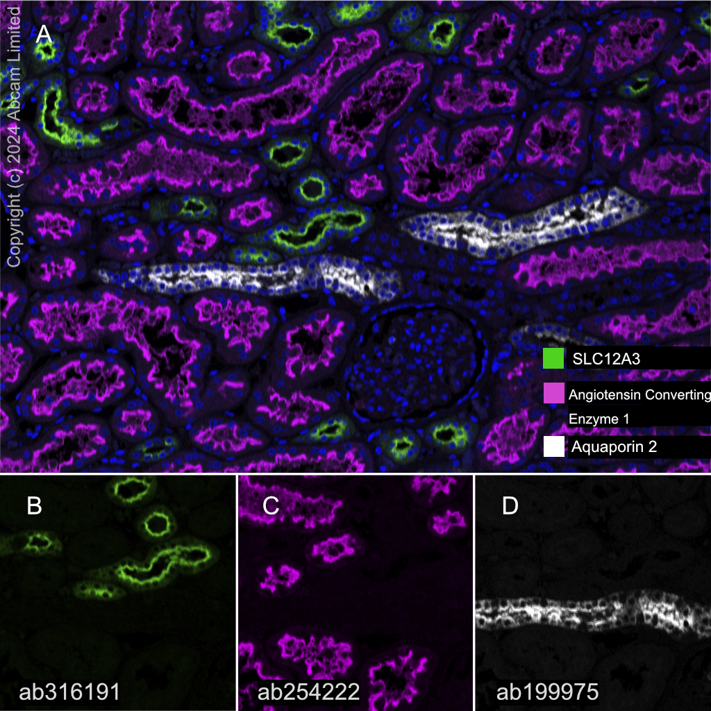 Multiplex immunohistochemistry - Anti-Angiotensin Converting Enzyme 1 antibody [EPR22291-247] (AB254222)