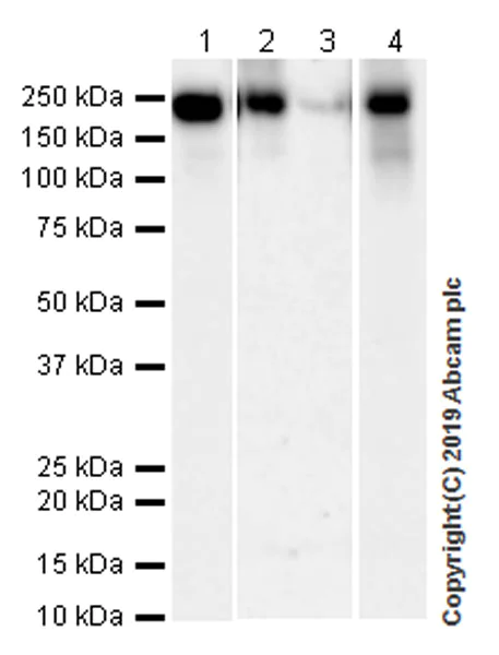 Western blot - Anti-Angiotensin Converting Enzyme 1 antibody [EPR22291-247] (AB254222)