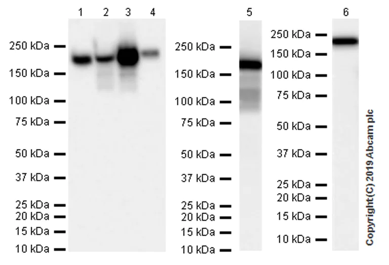 Western blot - Anti-Angiotensin Converting Enzyme 1 antibody [EPR22291-247] (AB254222)