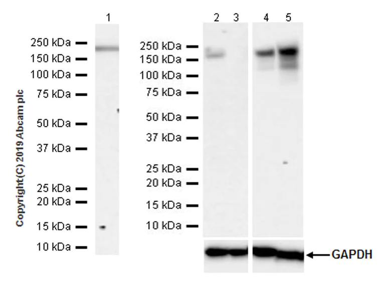 Western blot - Anti-Angiotensin Converting Enzyme 1 antibody [EPR22291-247] (AB254222)