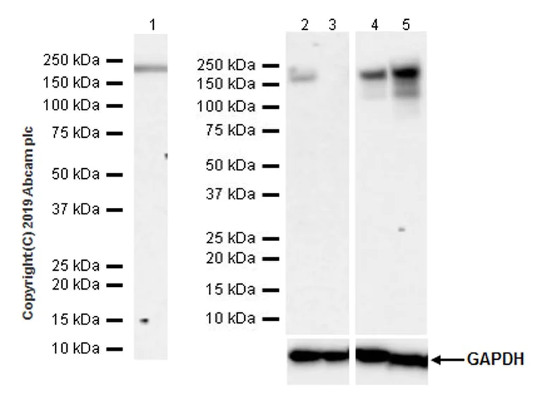 Western blot - Anti-Angiotensin Converting Enzyme 1 antibody [EPR22291-247] - BSA and Azide free (AB254278)