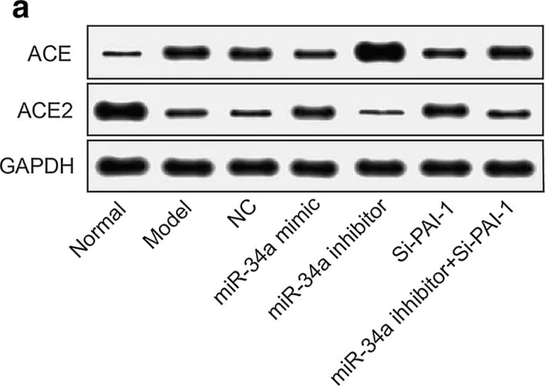 Western blot - Anti-Angiotensin Converting Enzyme 1 antibody [EPR22291-247] - BSA and Azide free (AB254278)