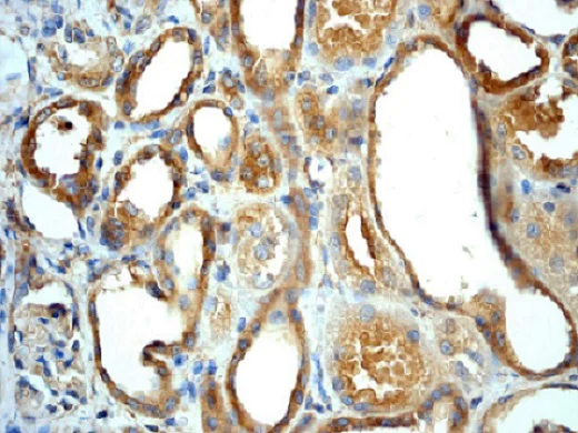 Immunohistochemistry (Formalin/PFA-fixed paraffin-embedded sections) - Anti-Angiotensin Converting Enzyme 1 antibody [EPR2757] (AB75762)