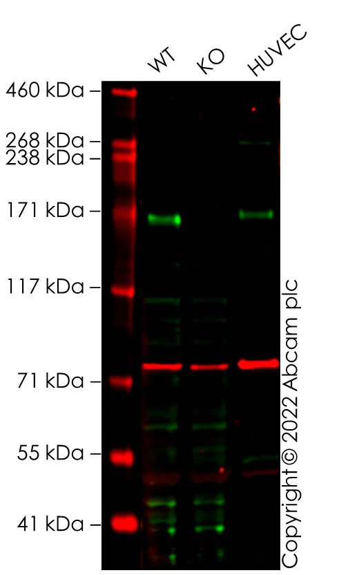 Western blot - Anti-Angiotensin Converting Enzyme 1 antibody [EPR2757] (AB75762)