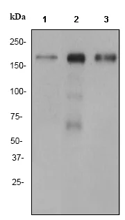 Western blot - Anti-Angiotensin Converting Enzyme 1 antibody [EPR2757] (AB75762)