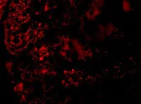 Immunocytochemistry/ Immunofluorescence - Anti-Angiotensin II Type 1 Receptor antibody (AB124505)