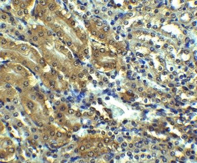 Immunohistochemistry (Formalin/PFA-fixed paraffin-embedded sections) - Anti-Angiotensin II Type 1 Receptor antibody (AB124505)
