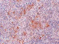 Immunohistochemistry (Formalin/PFA-fixed paraffin-embedded sections) - Anti-Angiotensin II Type 1 Receptor antibody (AB124505)