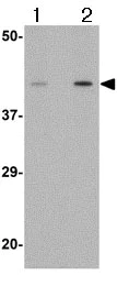 Western blot - Anti-Angiotensin II Type 1 Receptor antibody (AB124505)