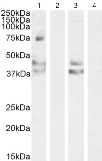 Western blot - Anti-Angiotensin II Type 1 Receptor antibody (AB59018)