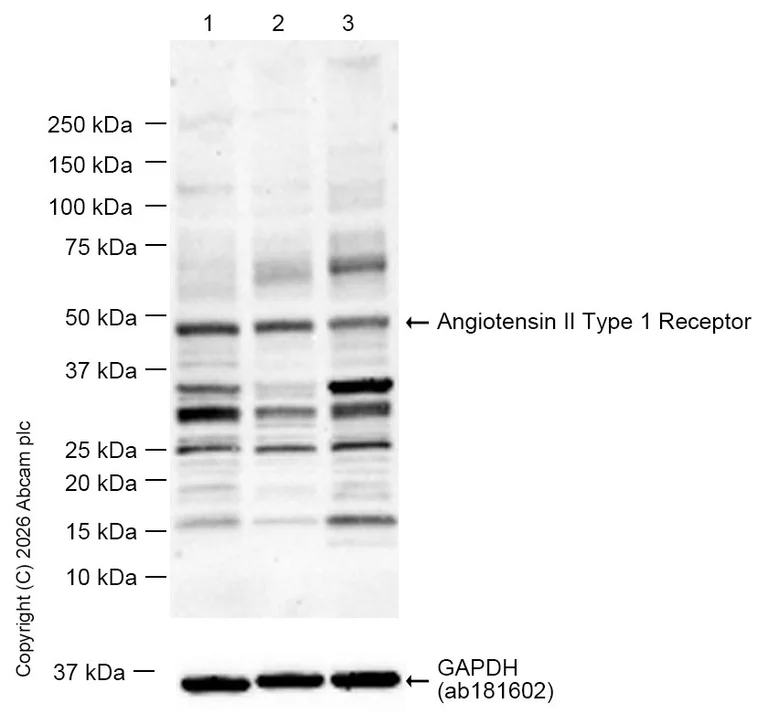 Western blot - Anti-Angiotensin II Type 1 Receptor antibody [EPR3873] (AB124734)
