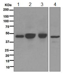 Western blot - Anti-Angiotensin II Type 1 Receptor antibody [EPR3873] (AB124734), expandable thumbnail