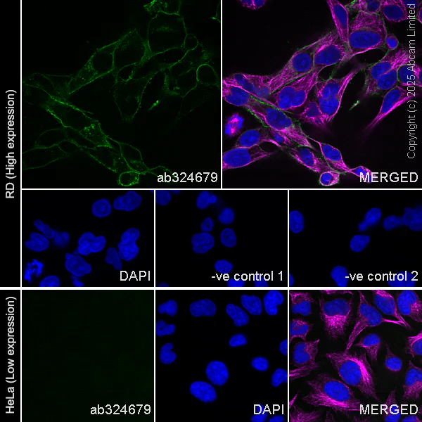 Immunocytochemistry - Anti-Angiotensin II Type 2 Receptor antibody [EPR30232-537] - BSA and Azide free (AB326595)