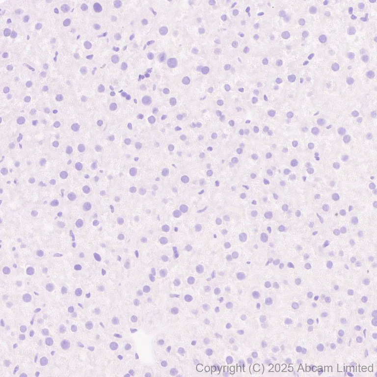 Immunohistochemistry - Anti-Angiotensin II Type 2 Receptor antibody [EPR30232-537] - BSA and Azide free (AB326595)