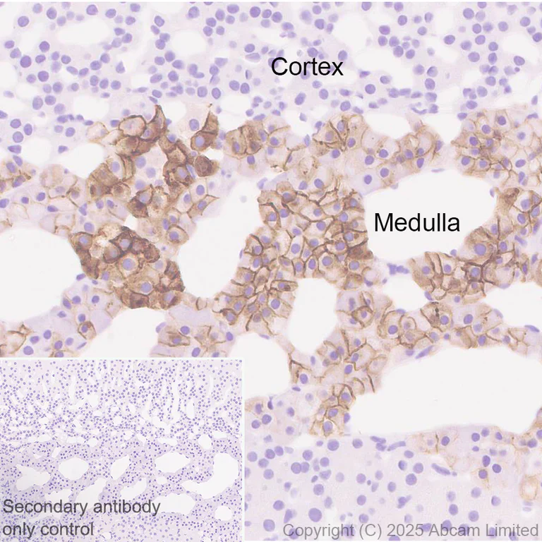 Immunohistochemistry - Anti-Angiotensin II Type 2 Receptor antibody [EPR30232-537] - BSA and Azide free (AB326595)