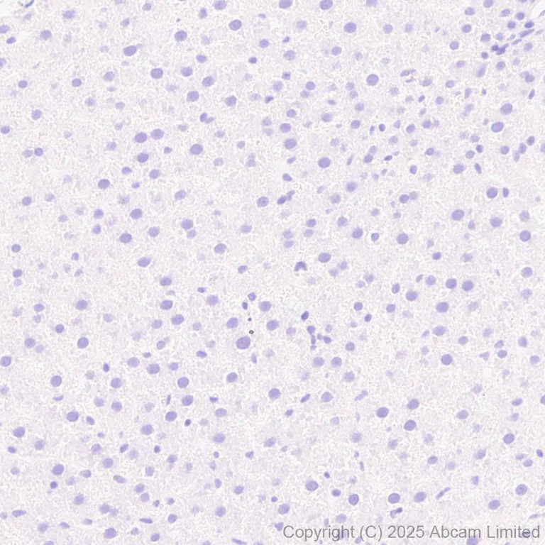 Immunohistochemistry - Anti-Angiotensin II Type 2 Receptor antibody [EPR30232-537] - BSA and Azide free (AB326595)