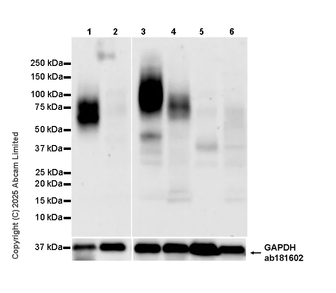 Western blot - Anti-Angiotensin II Type 2 Receptor antibody [EPR30232-537] - BSA and Azide free (AB326595)