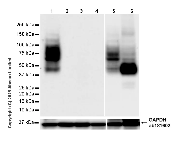 Western blot - Anti-Angiotensin II Type 2 Receptor antibody [EPR30232-537] - BSA and Azide free (AB326595)