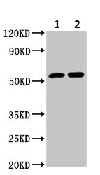 Western blot - Anti-Angiotensinogen antibody (AB236317)