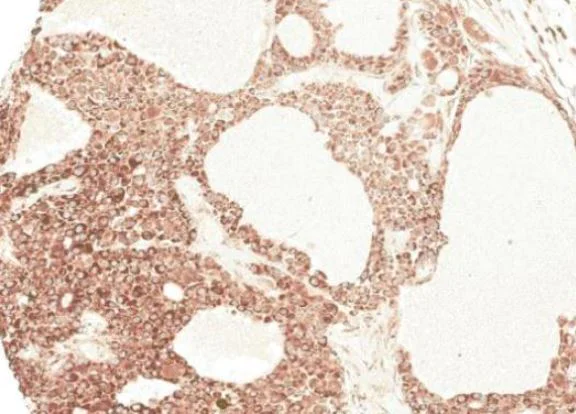 Immunohistochemistry (Formalin/PFA-fixed paraffin-embedded sections) - Anti-Angiotensinogen antibody (AB97381)