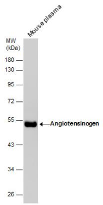 Western blot - Anti-Angiotensinogen antibody (AB97381), expandable thumbnail