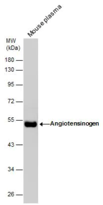 Western blot - Anti-Angiotensinogen antibody (AB97381)
