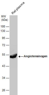 Western blot - Anti-Angiotensinogen antibody (AB97381), expandable thumbnail