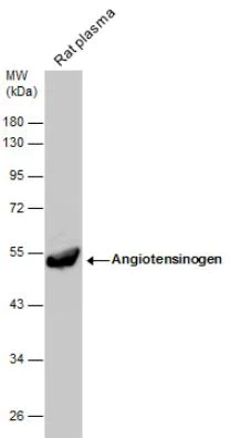 Western blot - Anti-Angiotensinogen antibody (AB97381)