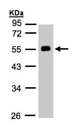 Western blot - Anti-Angiotensinogen antibody (AB97381)