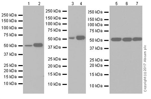 Western blot - Anti-Angiotensinogen antibody [EPR20599] (AB213705)