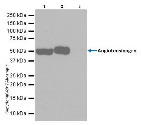 Immunoprecipitation - Anti-Angiotensinogen antibody [EPR20599] - BSA and Azide free (AB240389)