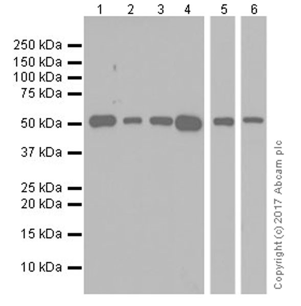 Western blot - Anti-Angiotensinogen antibody [EPR20599] - BSA and Azide free (AB240389)