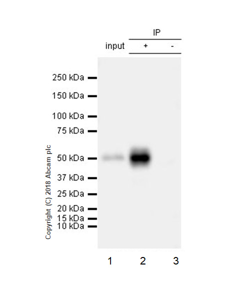 Immunoprecipitation - Anti-Angiotensinogen antibody [EPR22199-203] (AB229005), expandable thumbnail