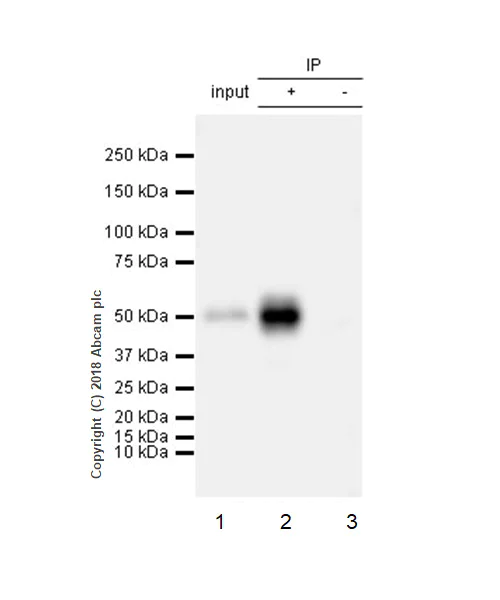 Immunoprecipitation - Anti-Angiotensinogen antibody [EPR22199-203] (AB229005)