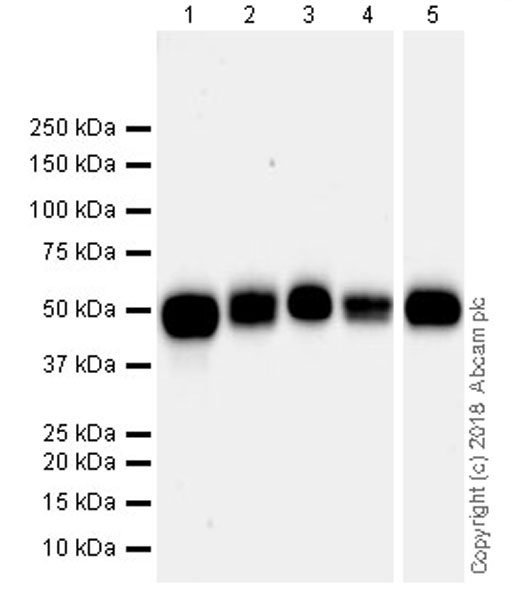 Western blot - Anti-Angiotensinogen antibody [EPR22199-203] (AB229005), expandable thumbnail