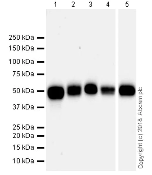 Western blot - Anti-Angiotensinogen antibody [EPR22199-203] (AB229005)