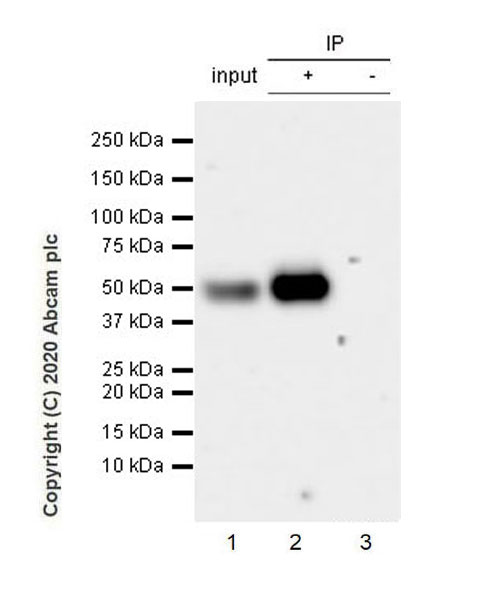 Immunoprecipitation - Anti-Angiotensinogen antibody [EPR24118-2] (AB276132), expandable thumbnail