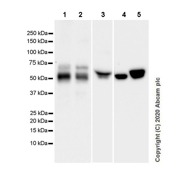 Western blot - Anti-Angiotensinogen antibody [EPR24118-2] (AB276132), expandable thumbnail