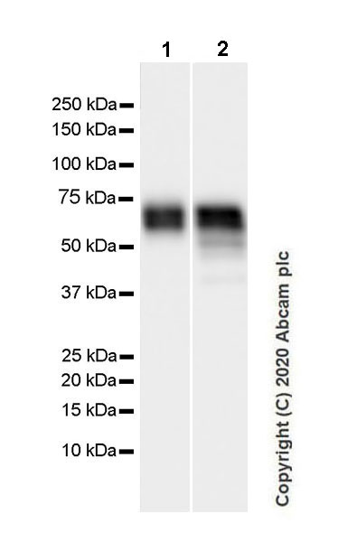 Western blot - Anti-Angiotensinogen antibody [EPR24118-2] (ab276132), expandable thumbnail