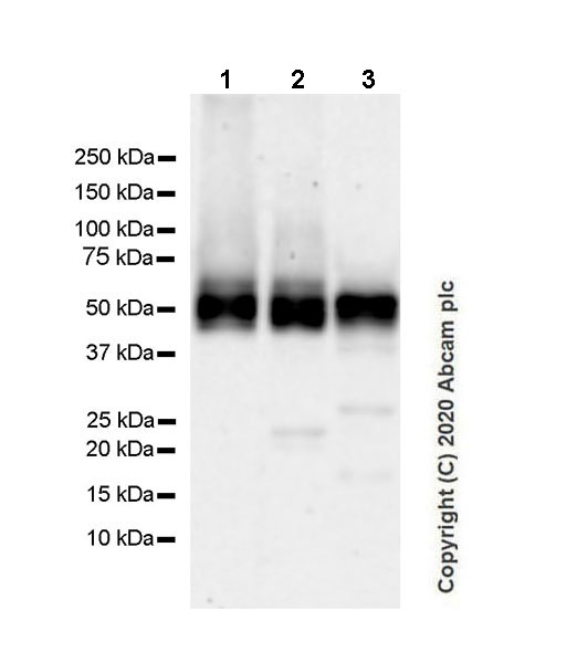 Western blot - Anti-Angiotensinogen antibody [EPR24118-2] (ab276132), expandable thumbnail