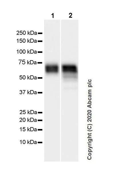 Western blot - Anti-Angiotensinogen antibody [EPR24118-2] - BSA and Azide free (AB276137)